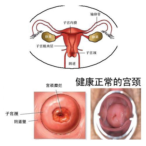 宫颈炎症严重了会怎么样