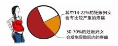 产科医生多图直击要点 | 妊娠期骨骼肌肉疼痛千万别忍！